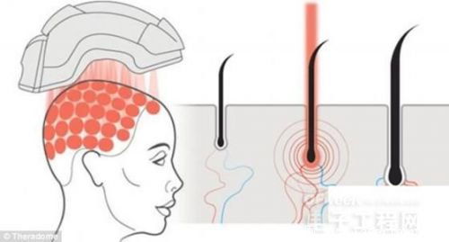 头盔是前美国航空航天局的科学家Tamim哈米德发明的,他是theradome创始人兼首席执行官。